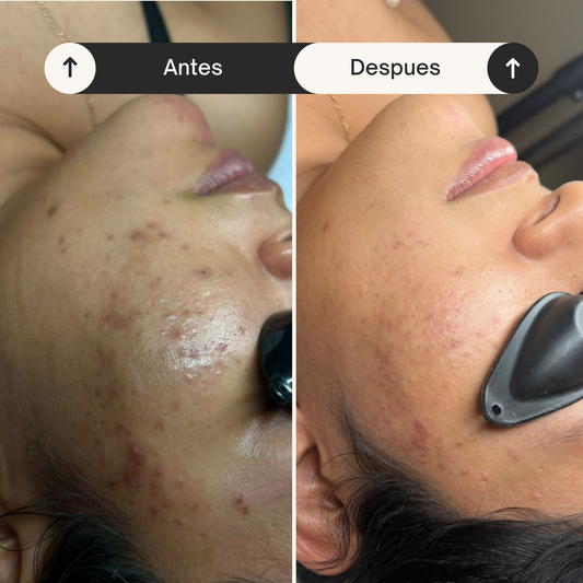 Mandelic Clear - Suero exfoliante anti-imperfecciones