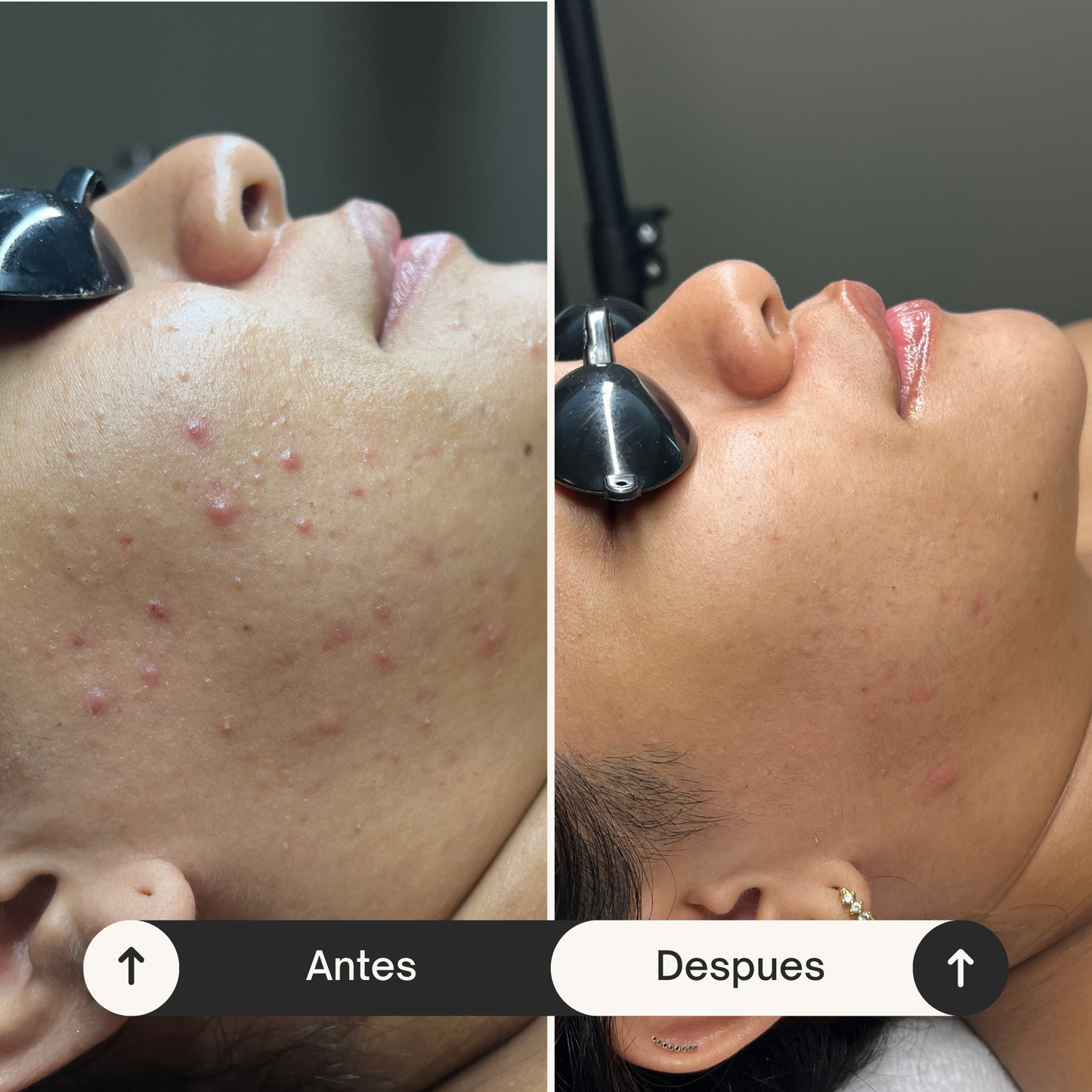 Magic Mist  - Solución multiusos de Plata Coloidal