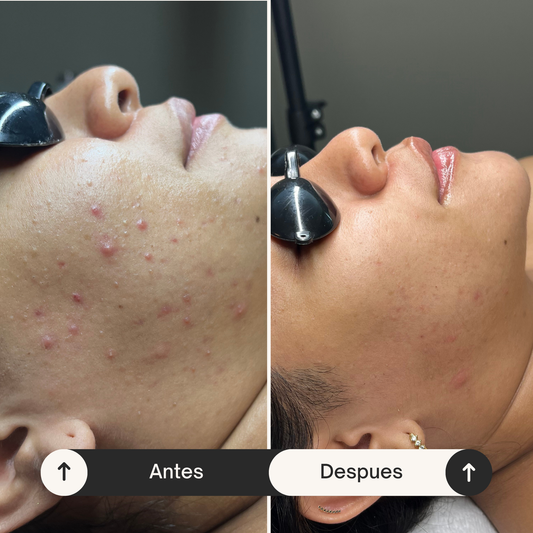 Magic Mist  - Solución multiusos de Plata Coloidal