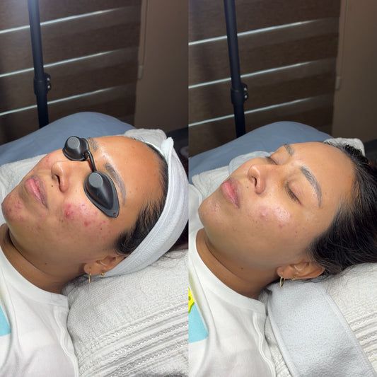 Sun Defense Tono Medio