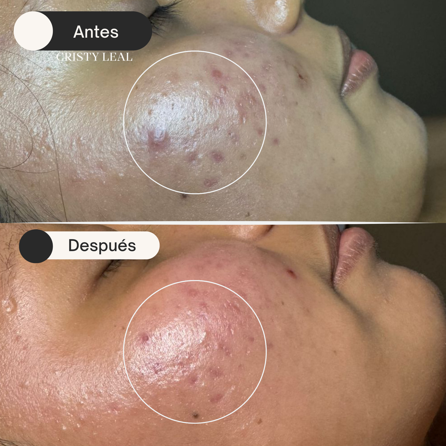 Ozone Clear  Hidratante purificante y equilibrante