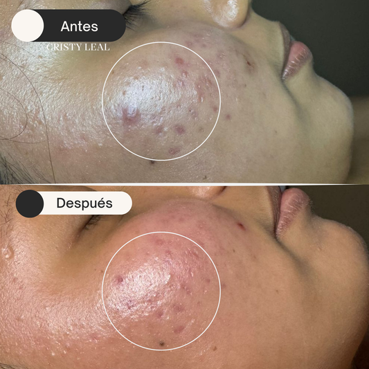 Ozone Clear  Hidratante purificante y equilibrante