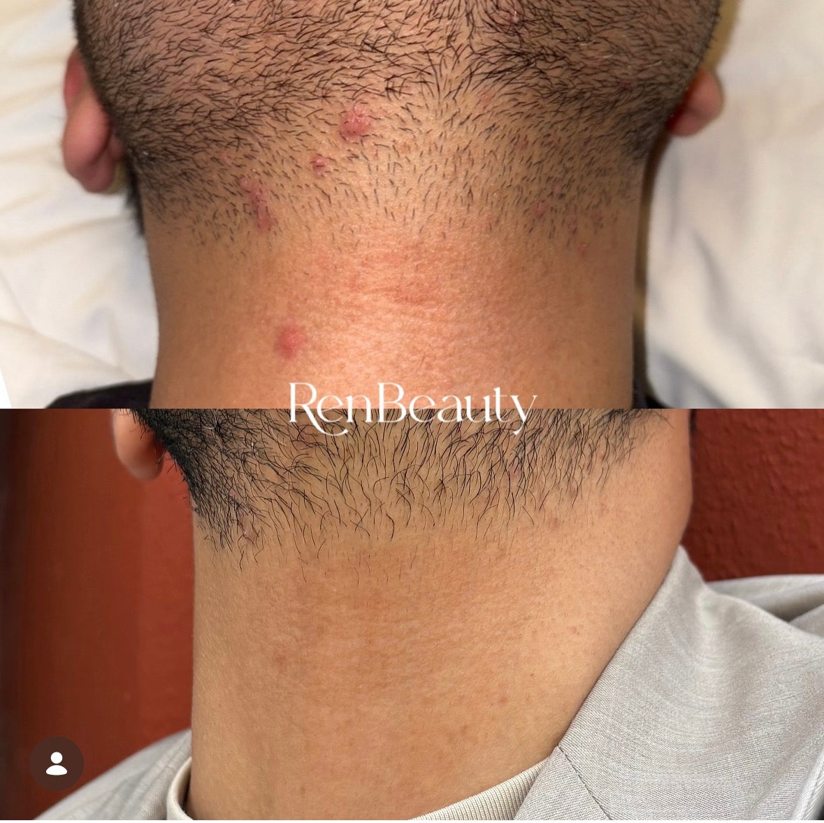 Ozone Clear  Hidratante purificante y equilibrante